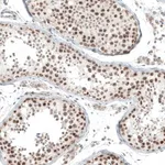 Merck Anti-HLTF antibody produced in rabbit