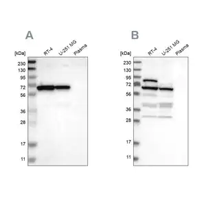 Merck Anti-NOP58 antibody produced in rabbit