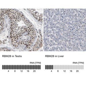 Merck Anti-RBM28 antibody produced in rabbit