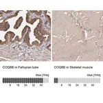Merck Anti-COQ8B antibody produced in rabbit