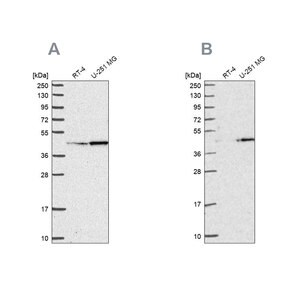 Merck Anti-WDR18 antibody produced in rabbit