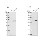 Merck Anti-WDR18 antibody produced in rabbit