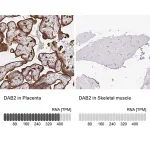 Merck Anti-DAB2 antibody produced in rabbit