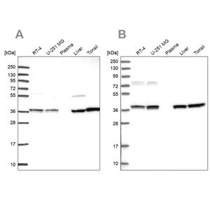 Merck Anti-TALDO1 antibody produced in rabbit