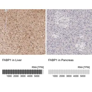 Merck Anti-FABP1 antibody produced in rabbit