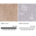 Merck Anti-FABP1 antibody produced in rabbit