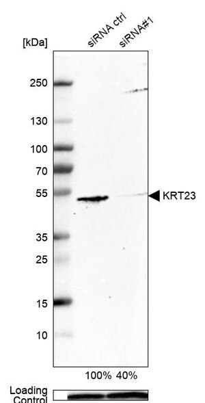Merck Anti-KRT23 antibody produced in rabbit