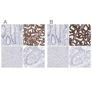 Merck Anti-CSN3 antibody produced in rabbit