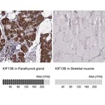 Merck Anti-KIF13B antibody produced in rabbit