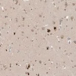 Merck Anti-MXI1 antibody produced in rabbit