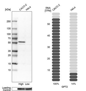 Merck Anti-GPT2 antibody produced in rabbit