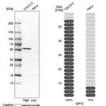 Merck Anti-GPT2 antibody produced in rabbit