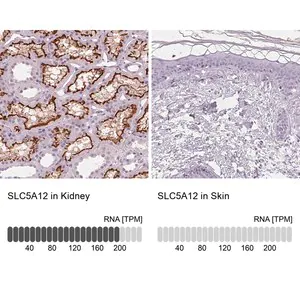 Merck Anti-SLC5A12 antibody produced in rabbit