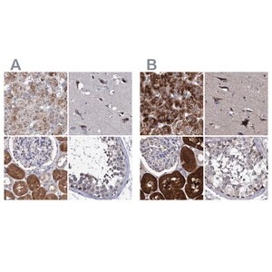 Merck Anti-CLPB antibody produced in rabbit