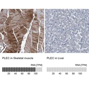 Merck Anti-PLEC antibody produced in rabbit