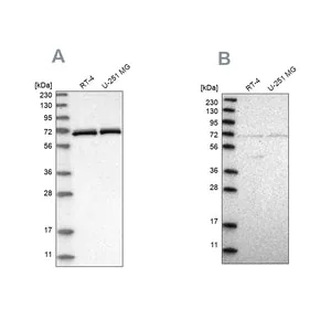 Merck Anti-NPLOC4 antibody produced in rabbit