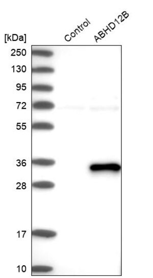 Merck Anti-ABHD12B antibody produced in rabbit