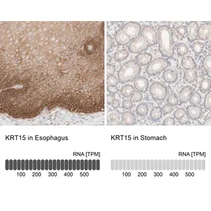 Merck Anti-KRT15 antibody produced in rabbit