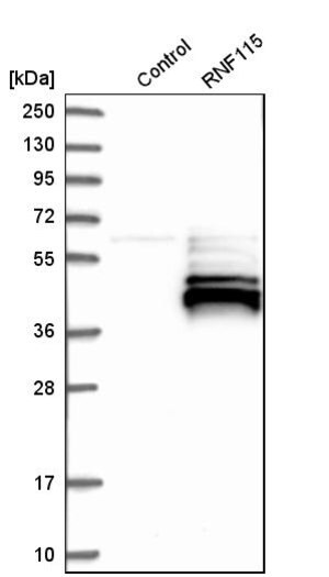 Merck Anti-RNF115 antibody produced in rabbit