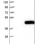 Merck Anti-ATP6V0D1 antibody produced in rabbit