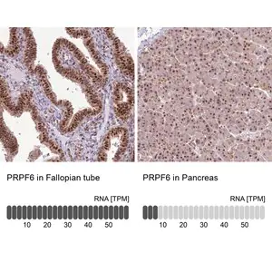Merck Anti-PRPF6 antibody produced in rabbit
