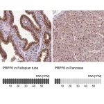 Merck Anti-PRPF6 antibody produced in rabbit