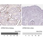 Merck Anti-ATP6V1G3 antibody produced in rabbit