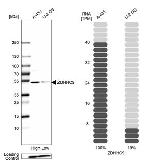 Merck Anti-ZDHHC9 antibody produced in rabbit