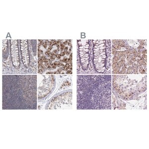 Merck Anti-ACOX2 antibody produced in rabbit