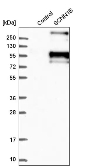Merck Anti-SCNN1B antibody produced in rabbit