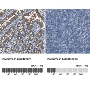 Merck Anti-ACADVL antibody produced in rabbit