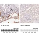 Merck Anti-SFTPD antibody produced in rabbit