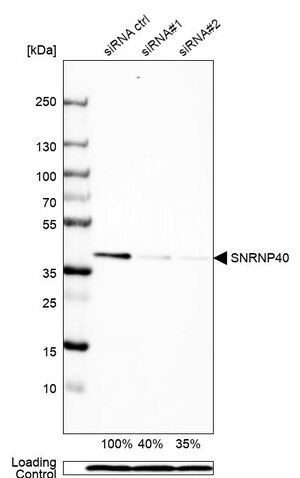 Merck Anti-SNRNP40 antibody produced in rabbit