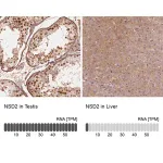 Merck Anti-NSD2 antibody produced in rabbit