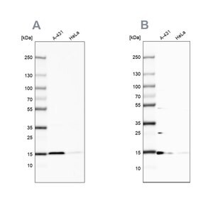 Merck Anti-CCDC58 antibody produced in rabbit