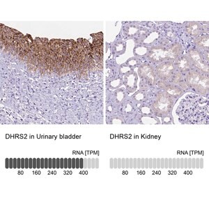 Merck Anti-DHRS2 antibody produced in rabbit