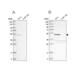 Merck Anti-SCP2 antibody produced in rabbit