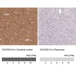 Merck Anti-CACNA1A antibody produced in rabbit