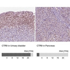 Merck Anti-CTR9 antibody produced in rabbit