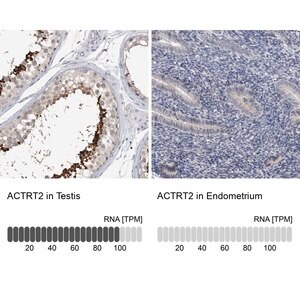 Merck Anti-ACTRT2 antibody produced in rabbit