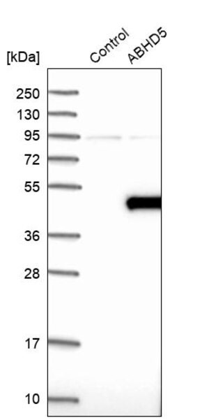 Merck Anti-ABHD5 antibody produced in rabbit