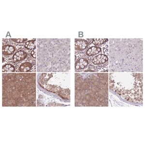 Merck Anti-PFDN6 antibody produced in rabbit