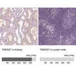 Merck Anti-TMEM27 antibody produced in rabbit
