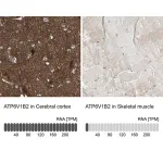 Merck Anti-ATP6V1B2 antibody produced in rabbit