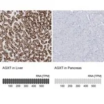 Merck Anti-AGXT antibody produced in rabbit