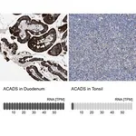 Merck Anti-ACADS antibody produced in rabbit