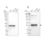 Merck Anti-ETFB antibody produced in rabbit