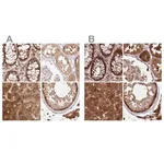 Merck Anti-GBE1 antibody produced in rabbit
