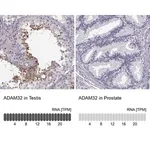 Merck Anti-ADAM32 antibody produced in rabbit