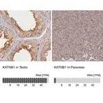 Merck Anti-KATNB1 antibody produced in rabbit